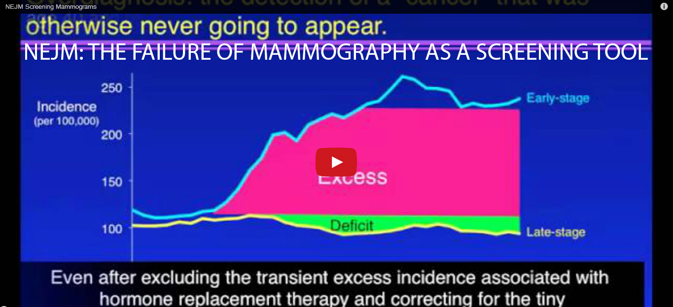 mammography has failed as a screening tool
